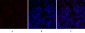 PERK Polyclonal Antibody